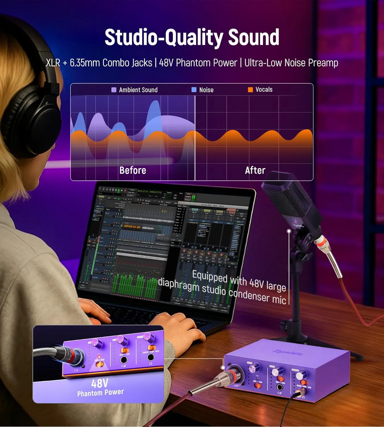 USB-C Audio Interface Bundle, All-in-One Audio Interface with XLR Dynamic Microphone, 48V Phantom Power, Stand, Monitor Earphone, Adapter Cables, perfect for PC Recording Podcasting, Purple